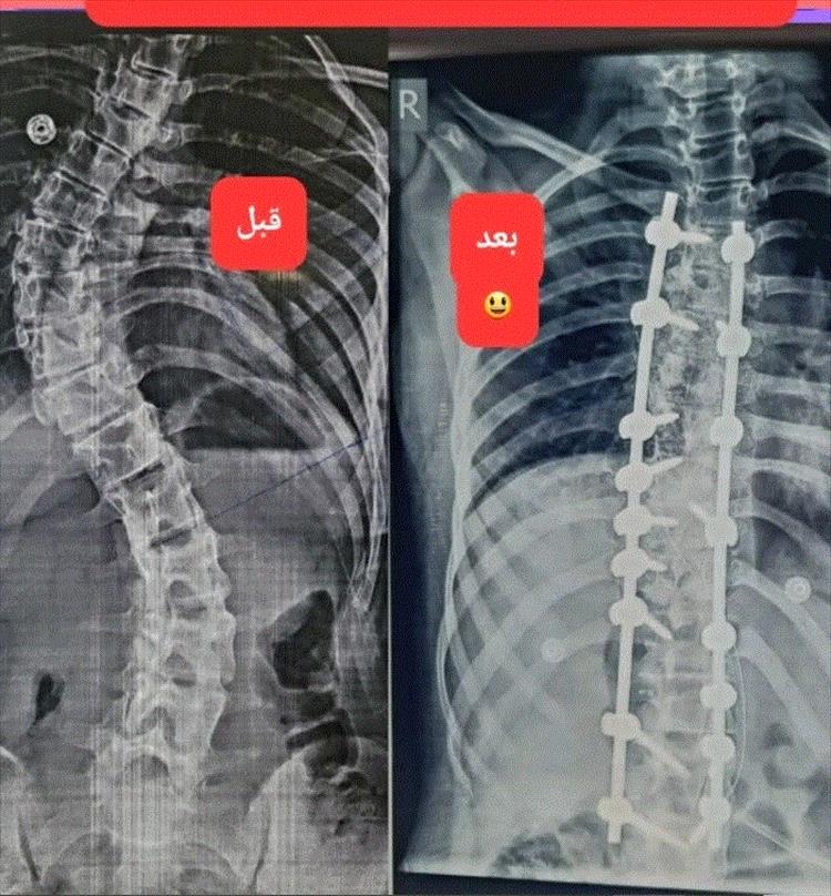 إنجاز طبي غير مسبوق في عدن